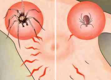 Comment identifier une morsure d'araignée 7 étapes (avec photos)