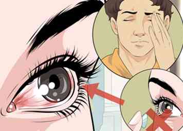 3 maneras de no tener miedo de las lentes de contacto