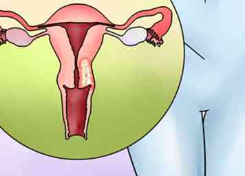 Cómo identificar manchas vaginales anormales entre períodos