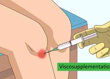 4 façons d'augmenter le liquide synovial