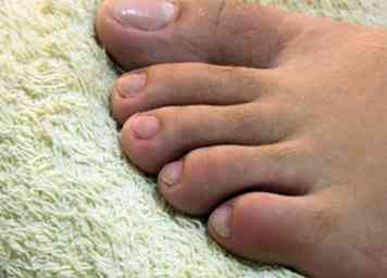 Sådan holder du dine fødder og toenails sund 10 trin