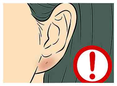 Sådan får du dine ører pierced (med billeder)