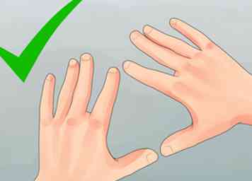 Comment guérir les mains sévèrement gercées 5 étapes (avec photos)