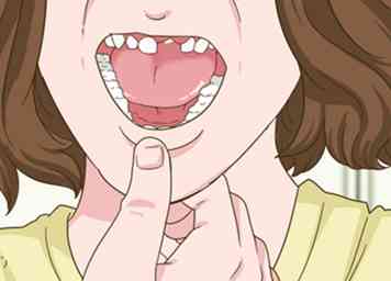 4 måder at smertefrit trække en løs baby tand