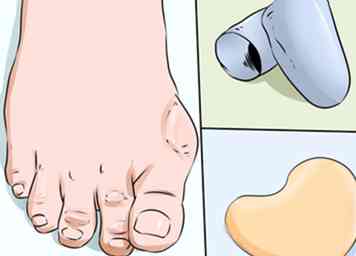 3 måder at forhindre calluses på hænder