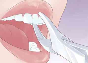 Cómo proteger un diente astillado (con fotos)