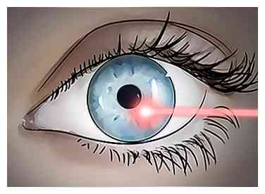3 façons de se débarrasser des flotteurs oculaires