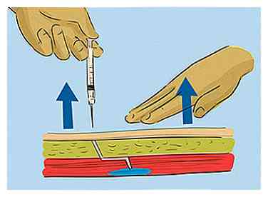 Ekspertrådgivning om, hvordan man giver en intramuskulær injektion