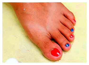 Sådan har du smukke toenails (med billeder)